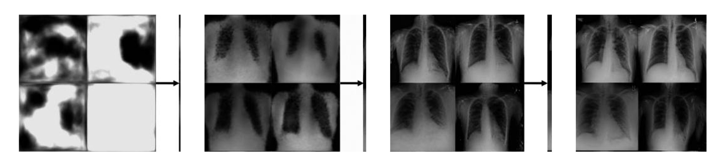 Enhanced Medical Imaging