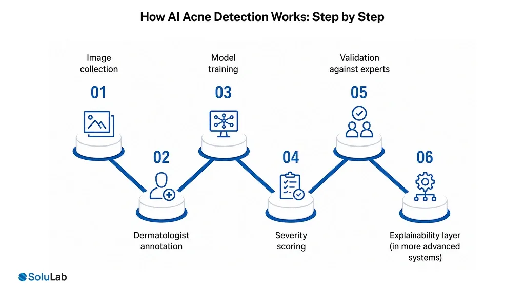 AI Acne Detection Works