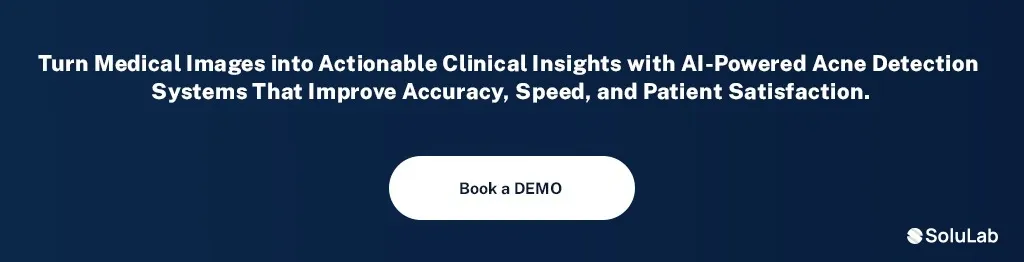 AI-powered acne detection